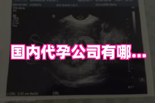 长春助孕网 4